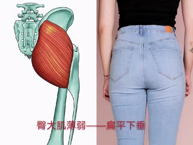 干货分享！深入剖析与腰痛相关的7块肌肉