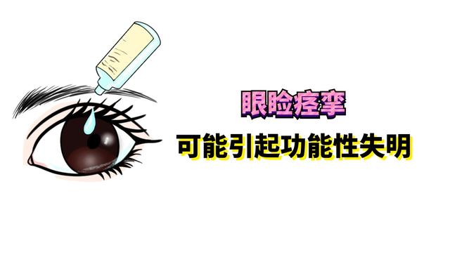 痉挛|哪只眼皮跳是好的呢？