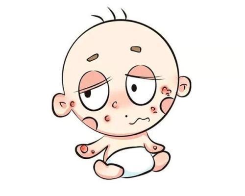 超级宝妈▲春季宝宝爱过敏，除了远离致敏因素，这几招妈妈也要知道