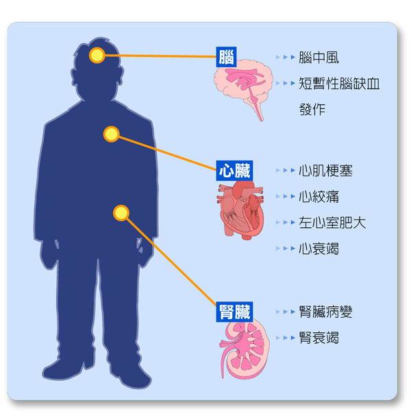 得了高血压，快来听听专家怎么说？