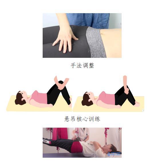 耻骨|产后疼痛，警惕“耻骨联合分离”