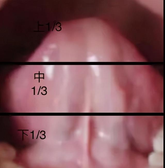 从舌相上能看出肌瘤和肌瘤生长部位吗？