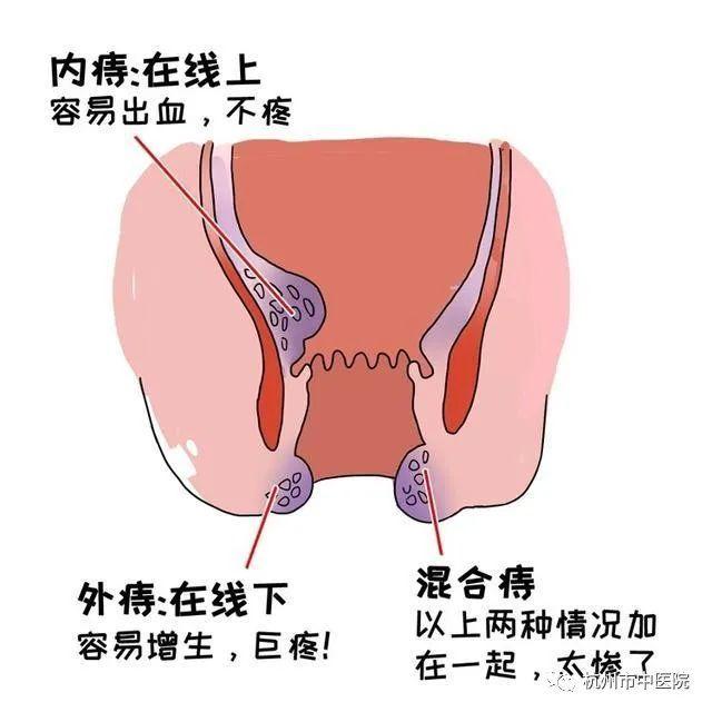 大二男生在内裤里垫卫生巾这个“隐疾”据说百分之九十的人都得过