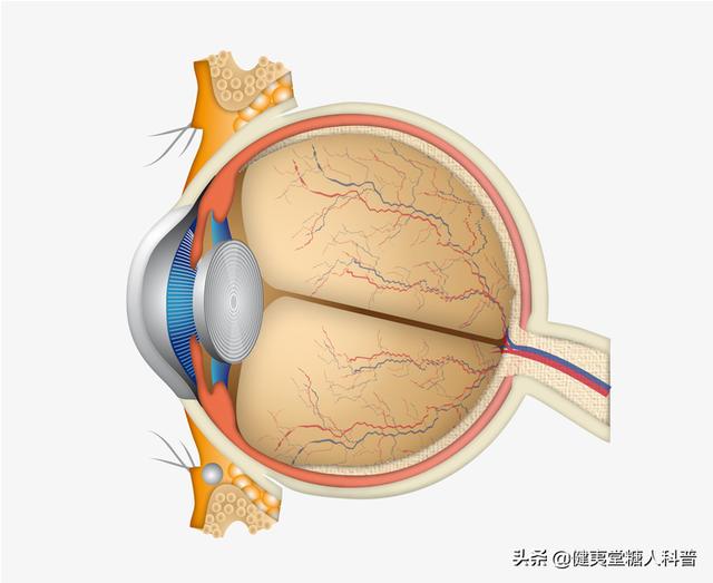 高血糖会危害心灵之窗，糖友须悉心呵护