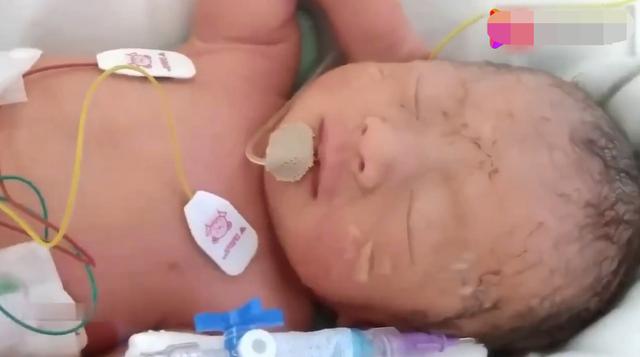 「你的育儿经」早产宝宝迷惑睡姿走红，单看上身乖巧，可看到下半身网友无法淡定