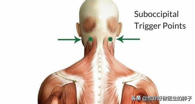 颈椎不好会出现头痛、头晕吗？医生：有可能，多见于这三种情况