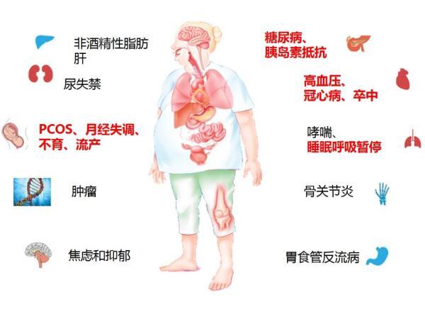 肥胖症|要想瘦，先吃对