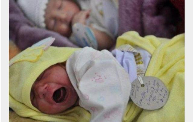 【超级宝妈】出生因没双臂惨遭遗弃,女孩2岁才被美国夫妇收养,孩子现在咋样