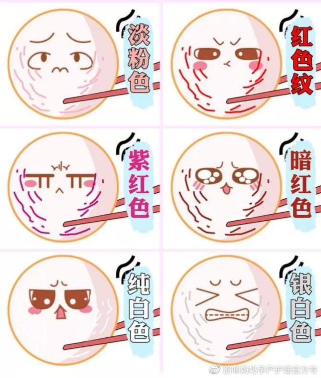 超幸福一家|孕妈护肤：如何预防和缓解妊娠纹？