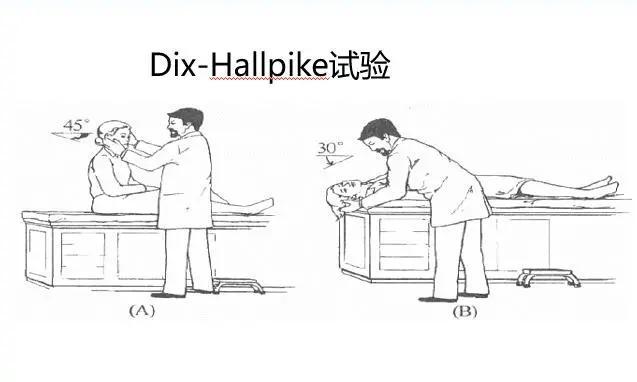 头晕绝大多数人都会经历，但有些不是缓缓就没事了