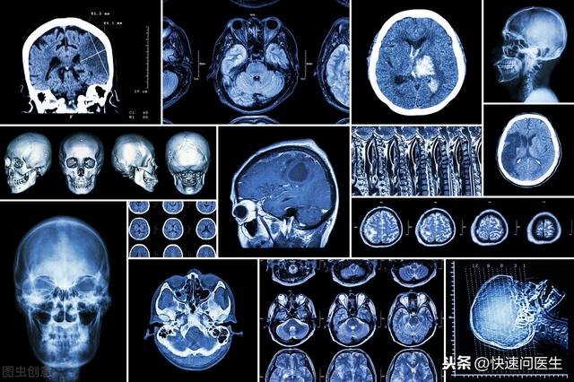 动不动就想着做CT真的好吗？对人体没有伤害吗，听听医生怎么说