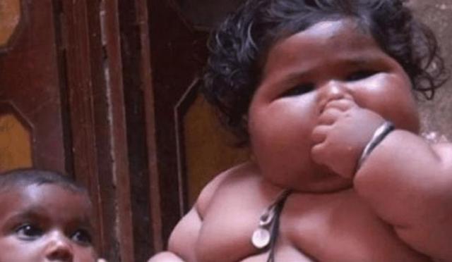 [超级宝妈]1岁体重就高达45斤的“米其林宝宝”，如今啥样了？不出人们所料