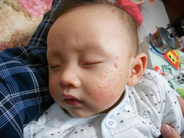 「你的育儿经」想要宝宝好，不湿疹，家长戒掉这4个坏习惯，宝宝自然就健康