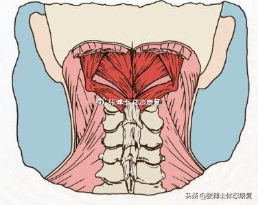 肌肉疲劳|「体态矫正」慢性颈肩痛，或许与你有头前伸的不良体态有关