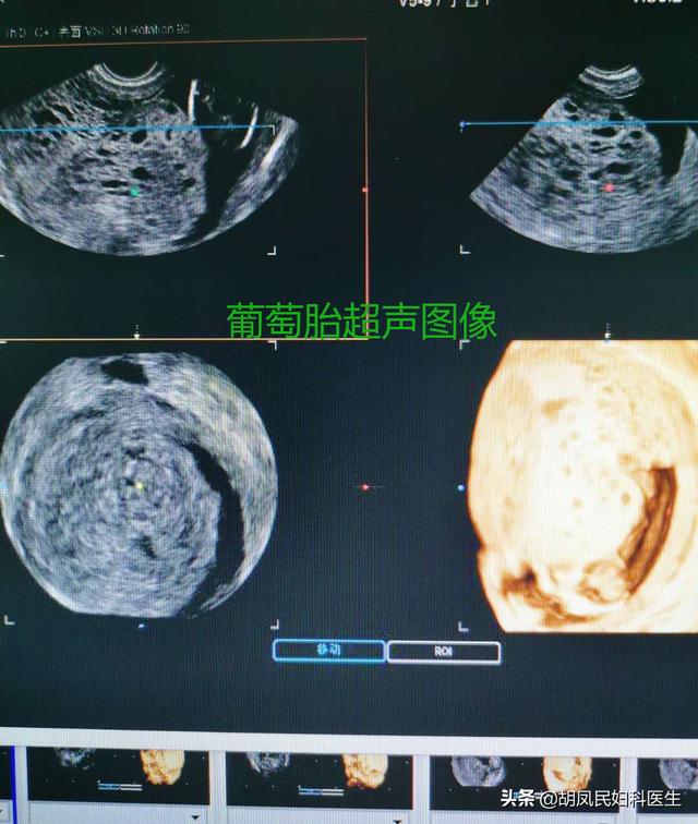 超级宝妈|你知道为什么要定期孕检么？因为胎儿发育中会发生意想不到的问题