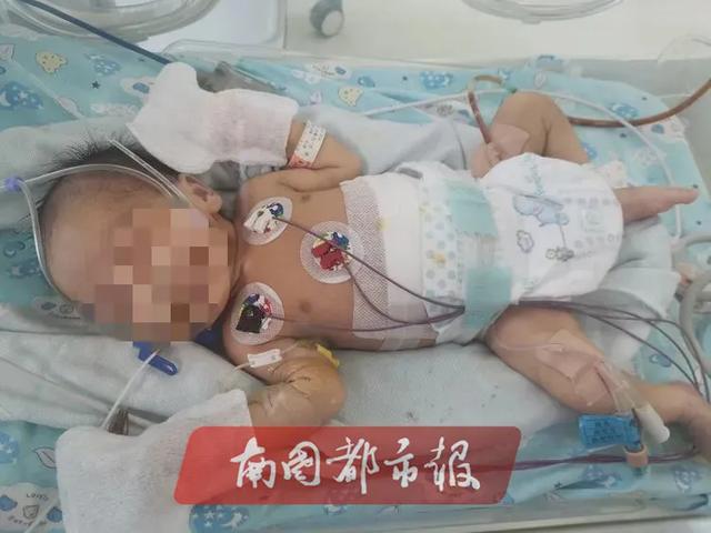 超级宝妈■1/50万的发生率！海口一男婴出生13天竟做“剖腹产”