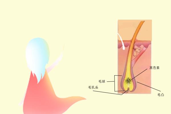 黑色素|“少白头”是因为黑色素细胞提前合成减少吗？