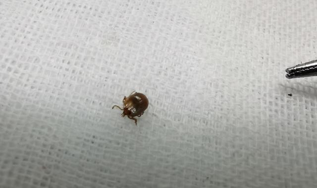 「你的育儿经」注意！身上出现这个“黑点”非常危险，六安已有人中招...