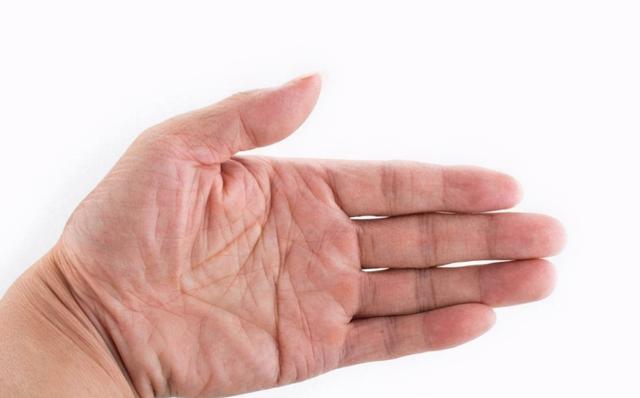 肝不好的人，可“竖中指”自查，没3点异常，肝癌、肝硬化绕着走