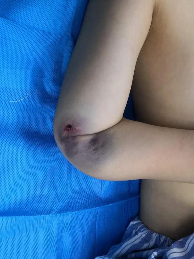阳阳的家|警惕！淄博一医院连续接诊4名孩子，受伤严重！很多家庭都有