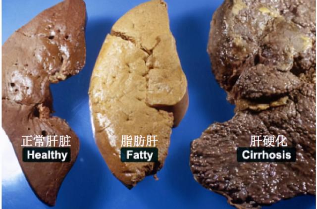 这3种遍地可见的草药是肝癌的救星，一种民间偏方却在销声匿迹