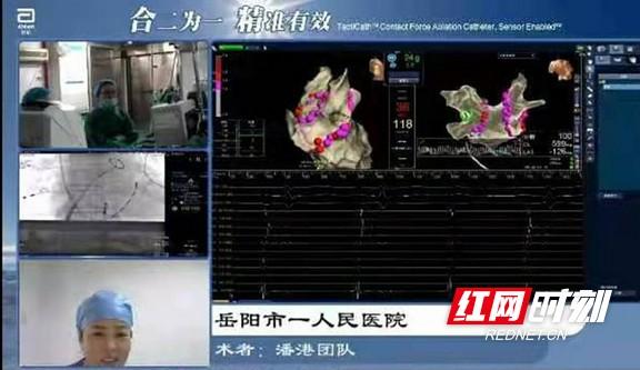 直播|岳阳市一人民医院精准房颤消融术跨省直播