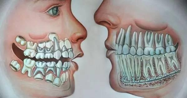 你的育儿经▲孩子换牙可不是小事，这些问题必须注意