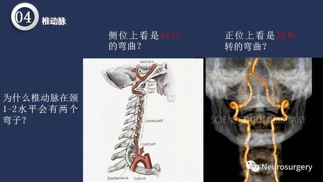 头颈动脉系统相关解剖