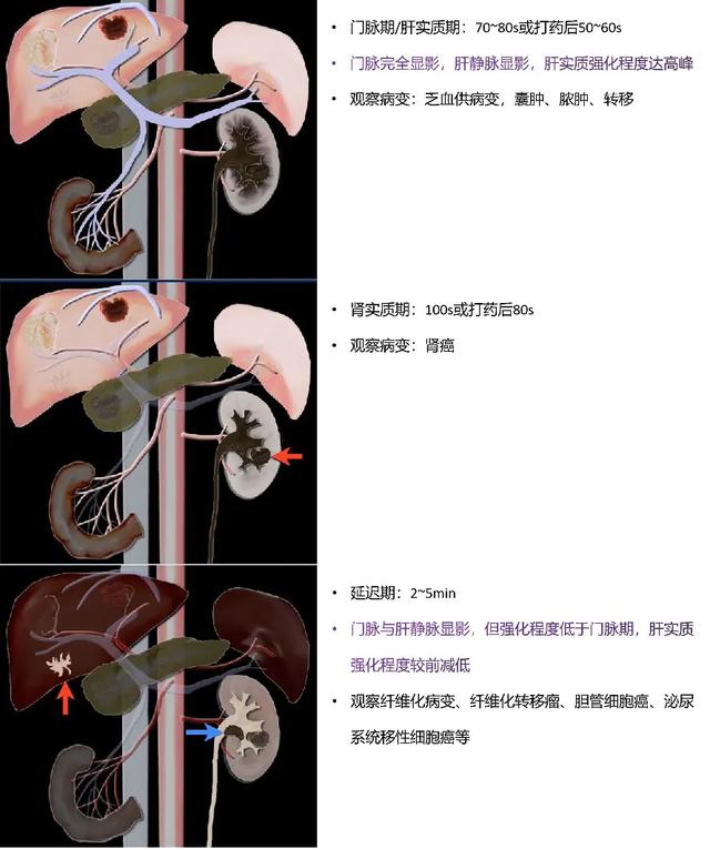 什么是 CT 增强？强化程度、模式、扫描时相等问题逐一解答