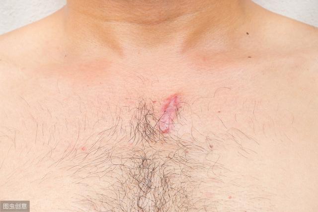 据医生说，你身体“毛发”状况预示着你的健康水平