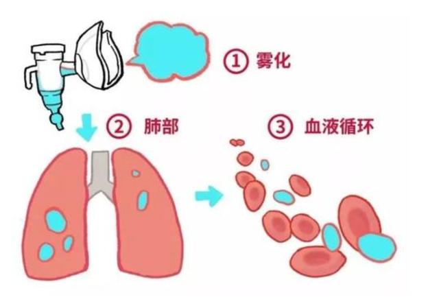你的育儿经|孩子咳嗽就该去做雾化吗？家长了解这些知识明明白白做雾化