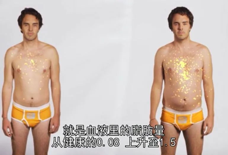 『夏以乔木』孩子脾气差、不长个、近视，罪魁祸首竟然是吃了这个……