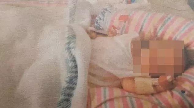【醉红颜】2岁女童体重不足10斤，竟是因为亲妈这样喂：这三种辅食，害了无数人