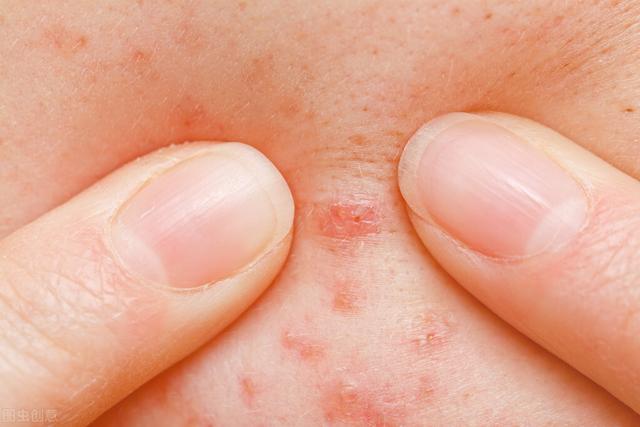 免疫力低，容易生病，或是体内毒素堆积，4个小妙招，或能助排毒