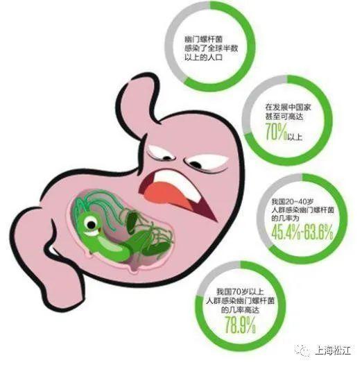 幽门螺杆菌会引发胃癌？听听松江消化内科医师怎么说