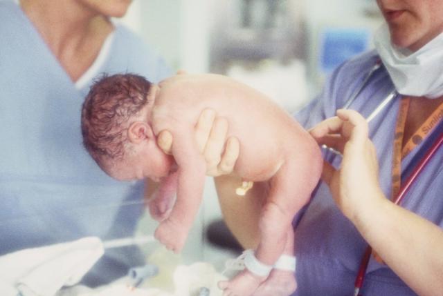 你的育儿经|宝宝出生可不都一定是头先出来,胎位不寻常,分娩难度也陡增