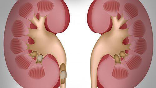 泌尿道|血尿原因有哪些？血尿如何治疗与预防？