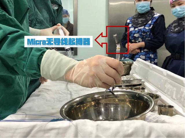 治疗缓慢性心律失常的“胶囊”起搏器（Micra）