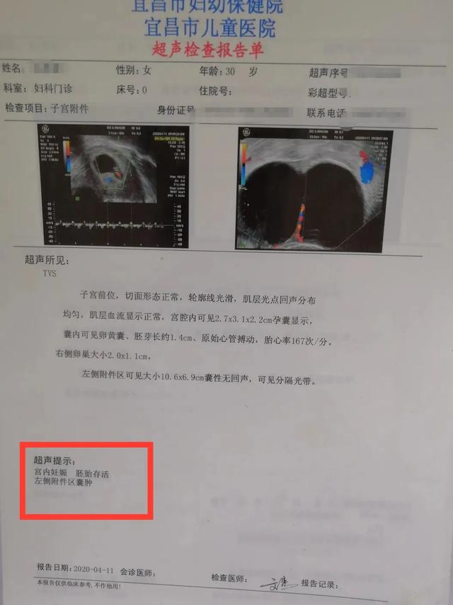 超级宝妈|年轻孕妈遭遇卵巢囊肿，保大还是保小？张翠菊：全保！！
