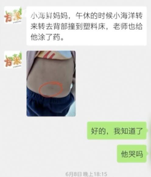 国民帅比|男童全托机构9天受伤3次？园方一个举动家长怒了