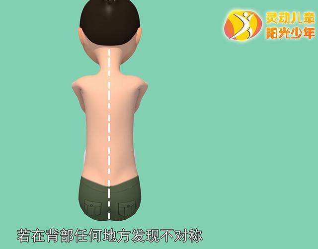 健康学堂|孩子高低肩，可能是病，这些脊柱侧凸自查方法，家长们一定要收藏