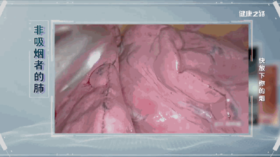 吸烟伤肺,伤血管,伤孩子!放下的是烟,拿起的是健康