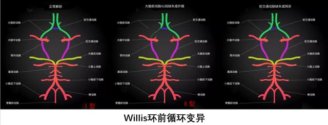 脑内的Willis环，你知道吗？