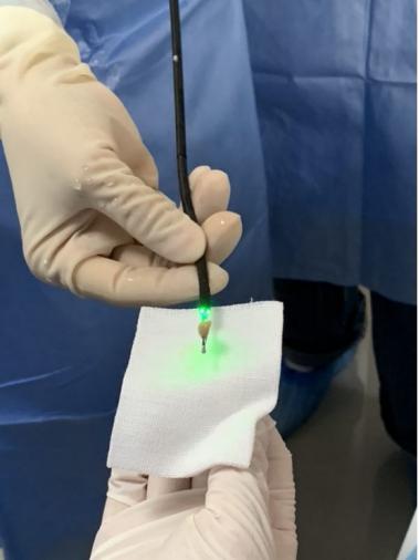 [快乐养生]咸阳彩虹医院成功帮助宝宝取出气管异物