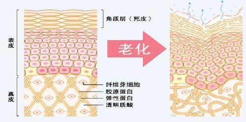 超级宝妈■干货|温和抗老成分——玻色因，你了解多少？