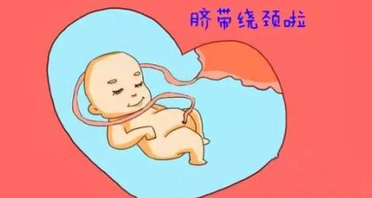 『你的育儿经』这几周是胎儿“脐带绕颈”高发周，孕妈该如何避免，这几步很关键