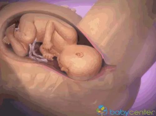 超级宝妈▲O型腿、X腿什么的可真是太烦了，宝宝可千万不要这样啊！