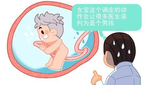 我们都是好孩子|产检是女儿出生却是儿子，“女翻男”概率多大？