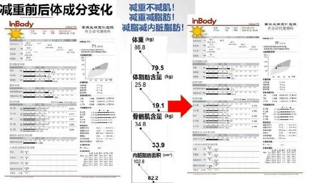 如何科学减肥？专家告诉你“肌”不可失