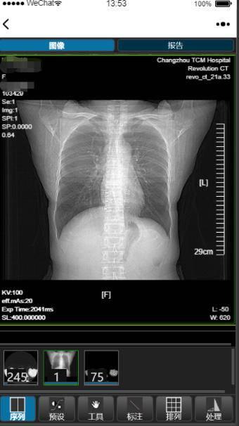 影像|告别纸袋+胶片，常州中医院开启“互联网+云影像”新时代